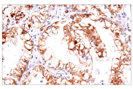 Immunohistochemistry Image 3: Cox2 (D5H5) XP<sup>®</sup> Rabbit mAb (BSA and Azide Free)