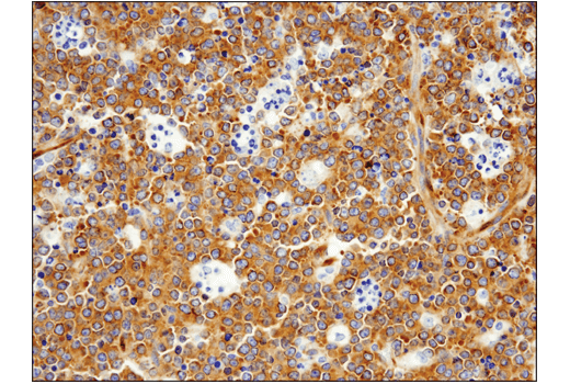Immunohistochemistry Image 3: FAK (D5O7U) Rabbit Monoclonal Antibody