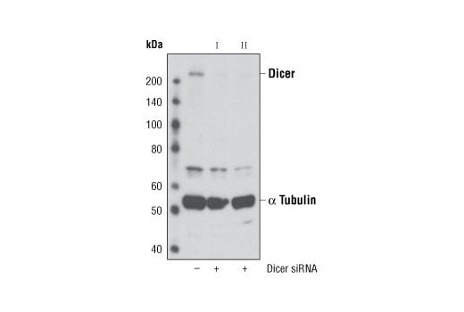 Western Blotting Image 2: Dicer Antibody