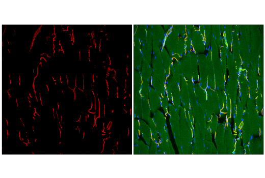 Immunofluorescence Image 3: Caveolin-1 (D46G3) XP<sup>®</sup> Rabbit mAb (Alexa Fluor<sup>®</sup> 647 Conjugate)