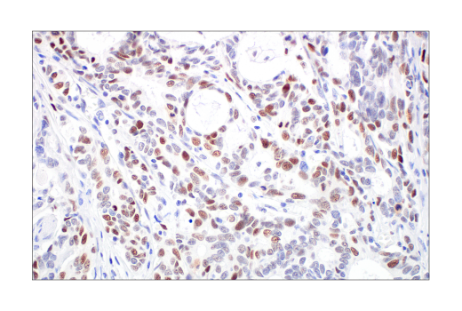Immunohistochemistry Image 3: Rb (4H1) Mouse Monoclonal Antibody