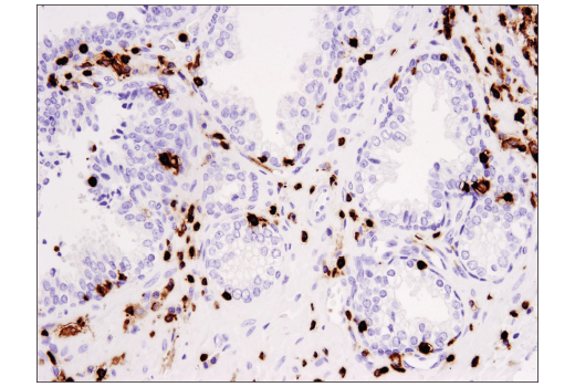 Immunohistochemistry Image 5: Coronin 1A (D6K5B) XP<sup>®</sup> Rabbit mAb