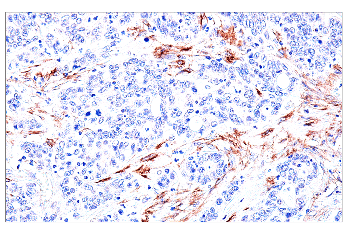 Immunohistochemistry Image 13: FAP (F1A4G) Rabbit Monoclonal Antibody
