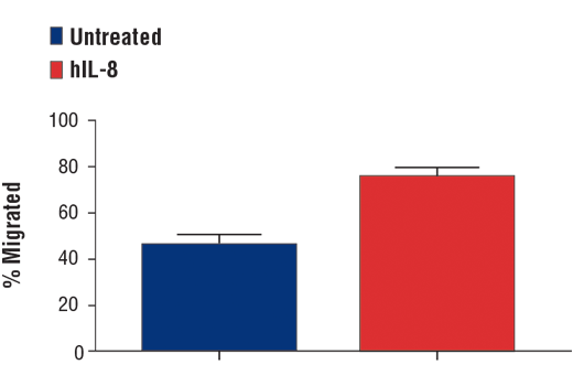 undefined Image 2: Human Interleukin-8 (hIL-8) Recombinant Protein