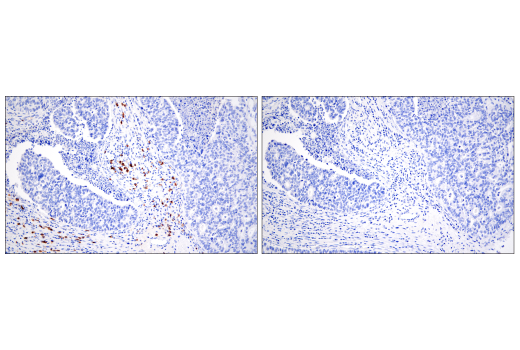 Immunohistochemistry Image 6: CD20 (E7B7T) Rabbit Monoclonal Antibody (BSA and Azide Free)