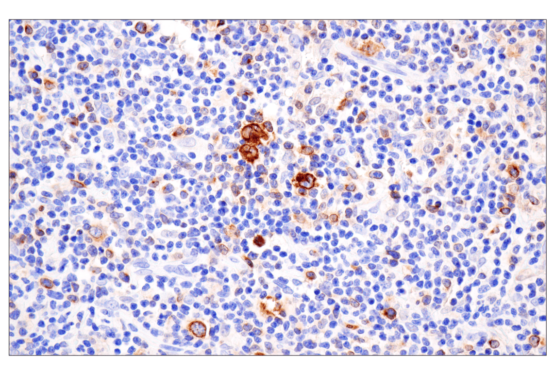 Immunohistochemistry Image 1: TNFRSF8/CD30 (E4L4I) Rabbit Monoclonal Antibody (BSA and Azide Free)