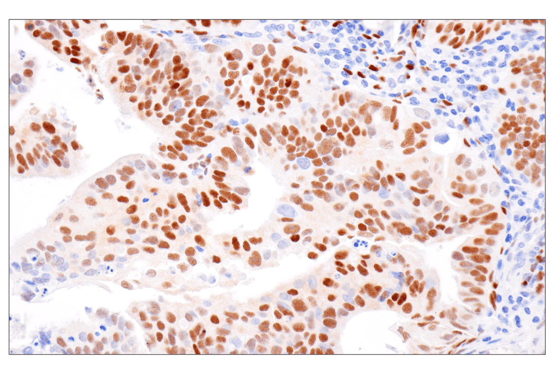 Immunohistochemistry Image 5: Estrogen Receptor alpha (D8H8) Rabbit Monoclonal Antibody