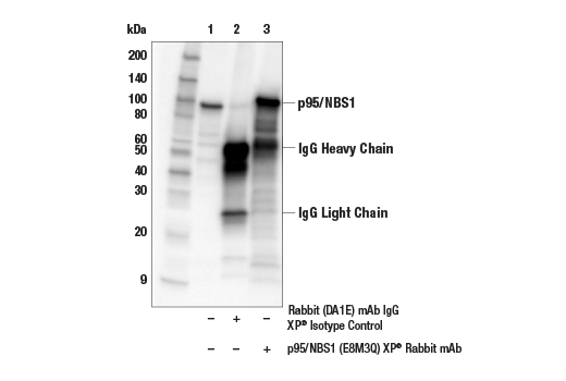 undefined Image 6: ATM Substrates Antibody Sampler Kit