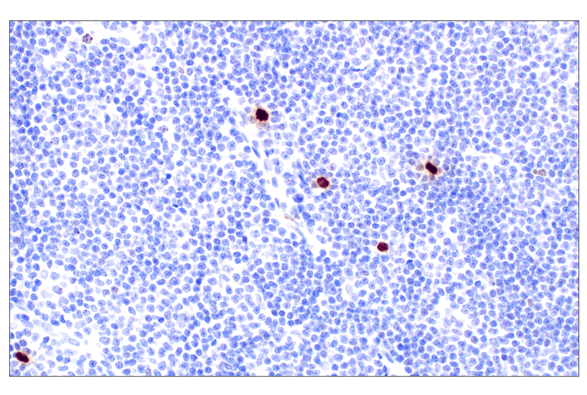 Immunohistochemistry Image 1: Phospho-Histone H3 (Ser10) (D7N8E) Rabbit Monoclonal Antibody