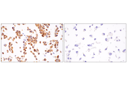 undefined Image 58: NF-kappaB Family Member Antibody Sampler Kit