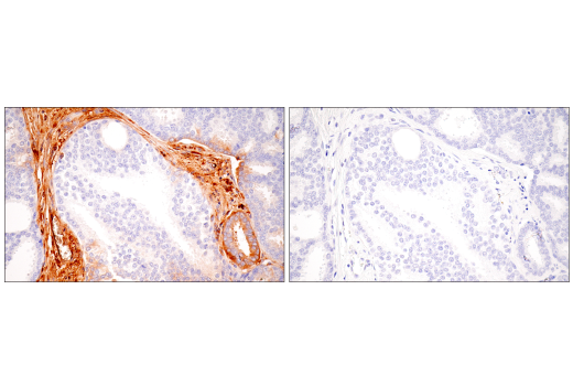 Immunohistochemistry Image 14: alpha-2-Macroglobulin (E6N7X) Rabbit Monoclonal Antibody