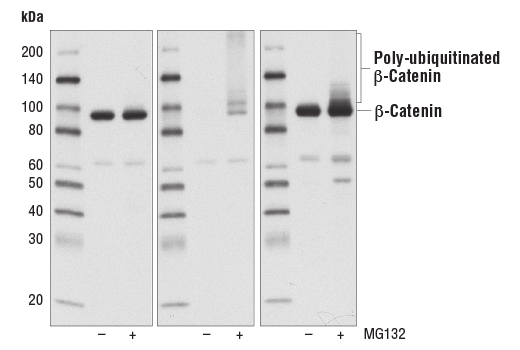 Western Blotting Image 2: Non-phospho (Active) beta-Catenin (Ser33/37/Thr41) (D13A1) Rabbit Monoclonal Antibody (BSA and Azide Free)