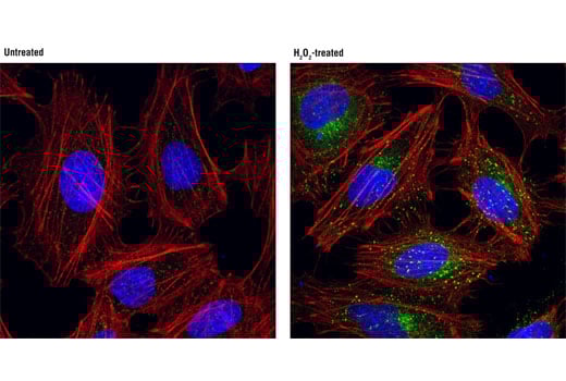 Immunofluorescence Image 1: Phospho-AP2M1 (Thr156) (D4F3) Rabbit Monoclonal Antibody