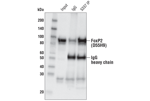 Immunoprecipitation Image 1: FoxP2 (D55H9) Rabbit Monoclonal Antibody
