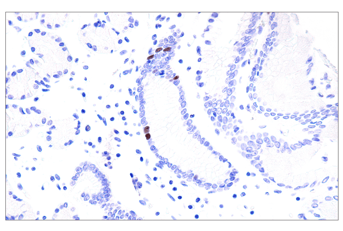 Immunohistochemistry Image 8: Phospho-NPM1 (Thr199) (E4C7S) Rabbit Monoclonal Antibody