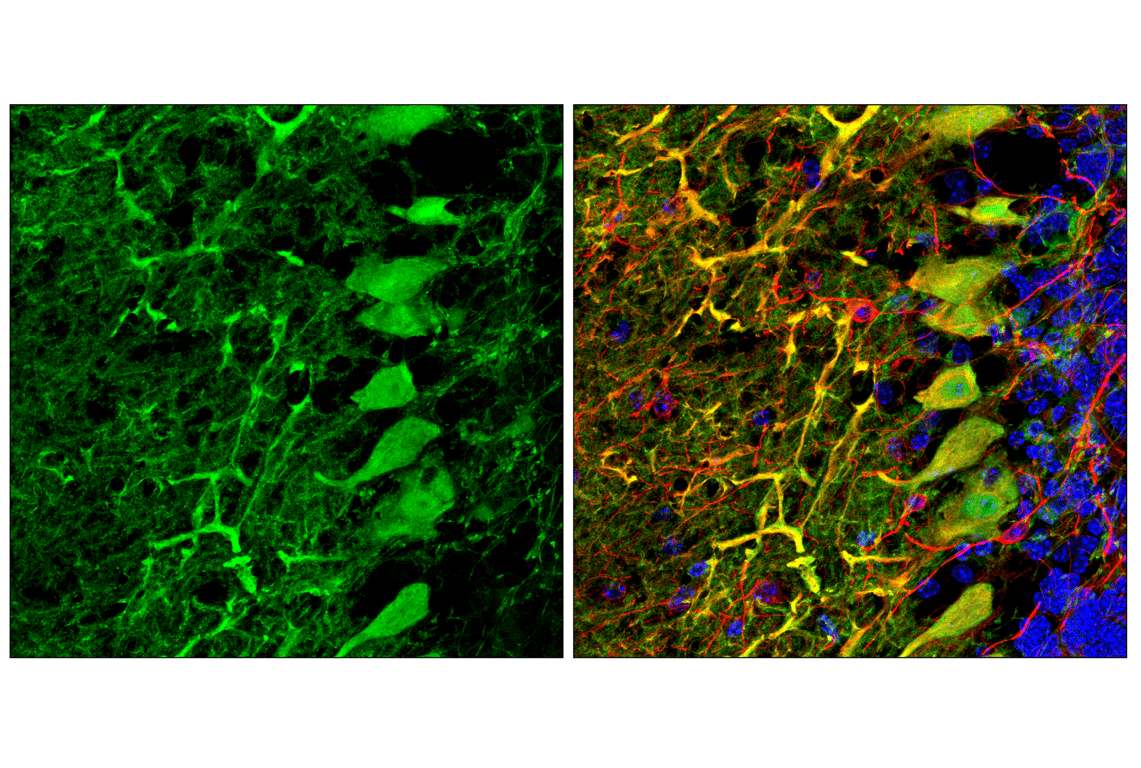 DARPP-32 (19A3) Rabbit Monoclonal Antibody | Cell Signaling Technology