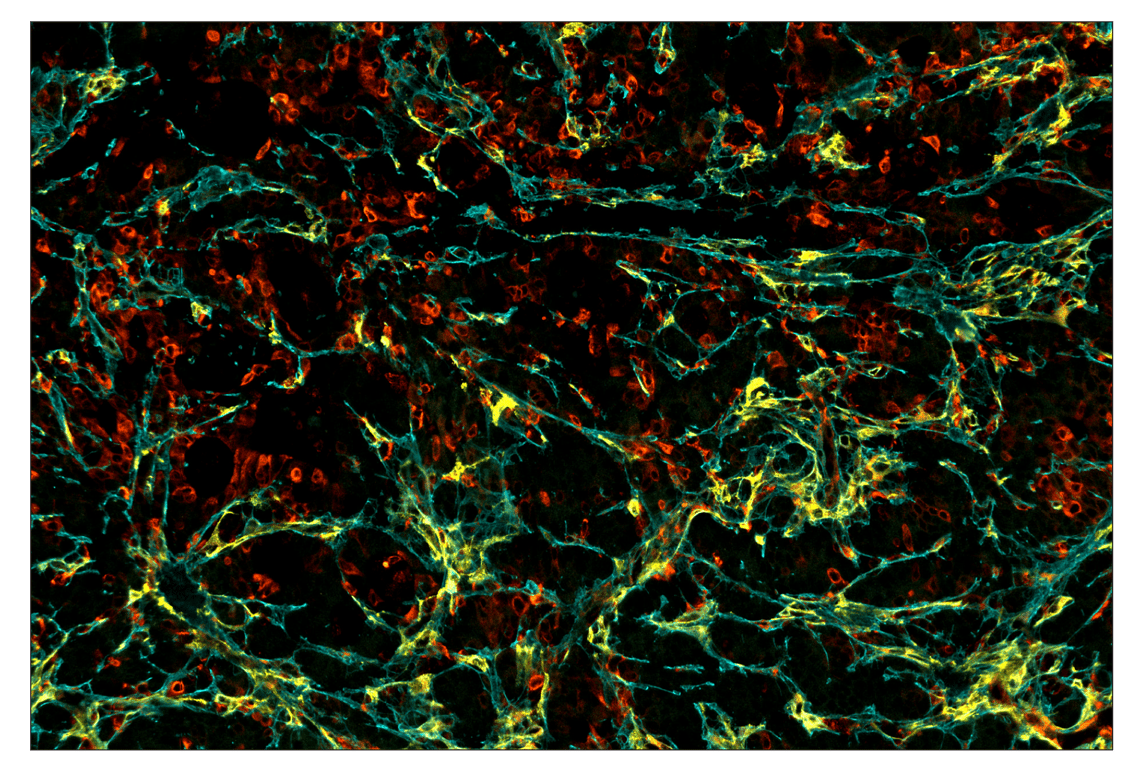 Immunohistochemistry Image 2: Phospho-S6 Ribosomal Protein (Ser235/236) (D57.2.2E) & CO-0107-488 SignalStar<sup>™</sup> Oligo-Antibody Pair