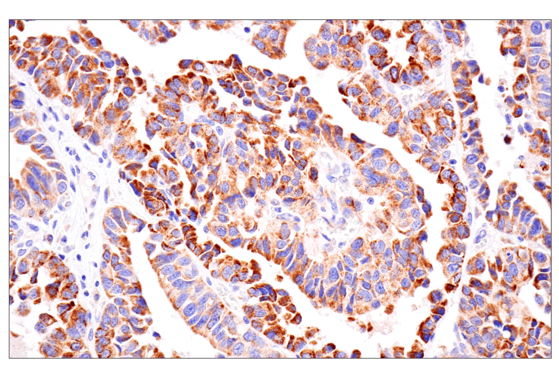 Immunohistochemistry Image 6: AMACR (F7T6V) Rabbit Monoclonal Antibody