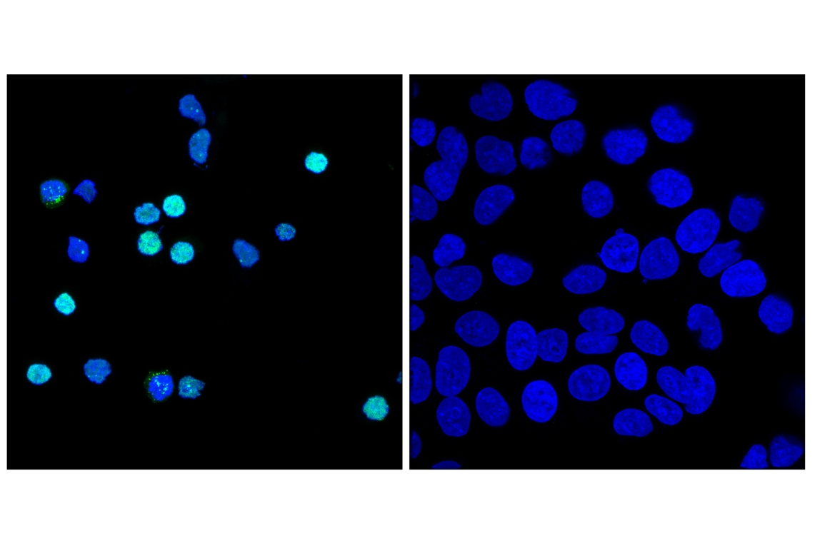 Immunofluorescence Image 1: Aiolos (D1C1E) Rabbit Monoclonal Antibody