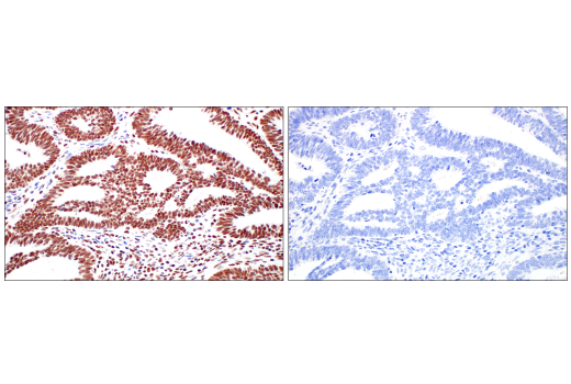 Immunohistochemistry Image 11: METTL3 (E3F2A) Rabbit Monoclonal Antibody (BSA and Azide Free)