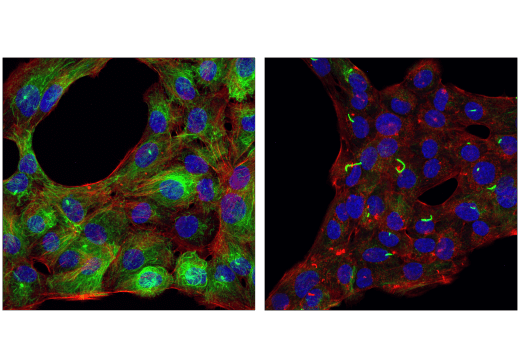 Immunofluorescence Image 1: Acetyl-alpha-Tubulin (Lys40) (D20G3) Rabbit Monoclonal Antibody