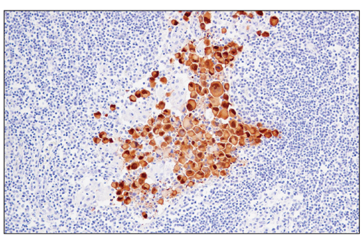 Immunohistochemistry Image 5: MAGE-A4 (E7O1U) Rabbit Monoclonal Antibody (BSA and Azide Free)