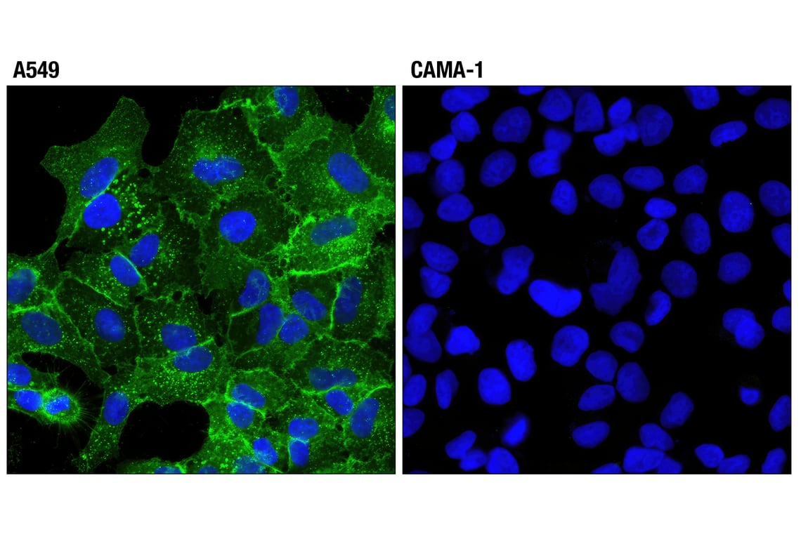 Immunofluorescence Image 1: EGF Receptor (D1D4J) Rabbit Monoclonal Antibody