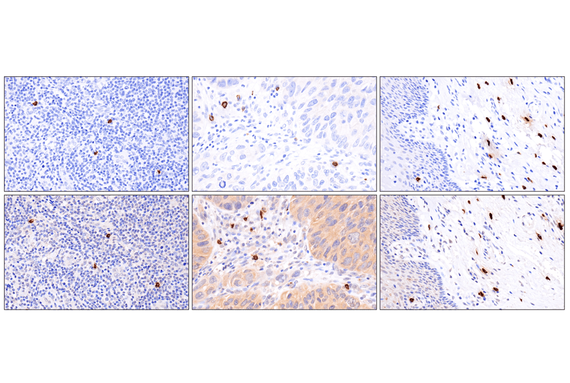 Immunohistochemistry Image 10: Mast Cell Chymase/CMA1 (F6S4Q) Rabbit Monoclonal Antibody