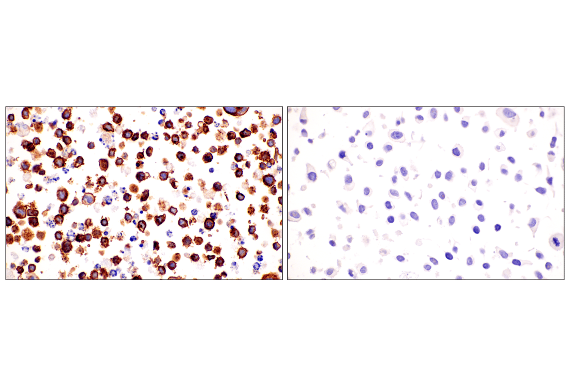 Immunohistochemistry Image 7: ESAM (F2Y5Q) Rabbit Monoclonal Antibody