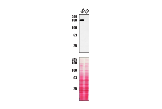 Western Blotting Image 3: Tuberin/TSC2 (D93F12) Rabbit Monoclonal Antibody (BSA and Azide Free)
