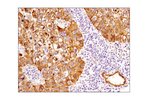 Immunohistochemistry Image 2: Jagged1 (D4Y1R) Rabbit Monoclonal Antibody