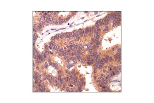 Immunohistochemistry Image 2: E-Cadherin Antibody