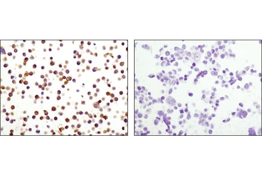 Immunohistochemistry Image 3: CD102/ICAM-2 (D7P2Q) Rabbit Monoclonal Antibody