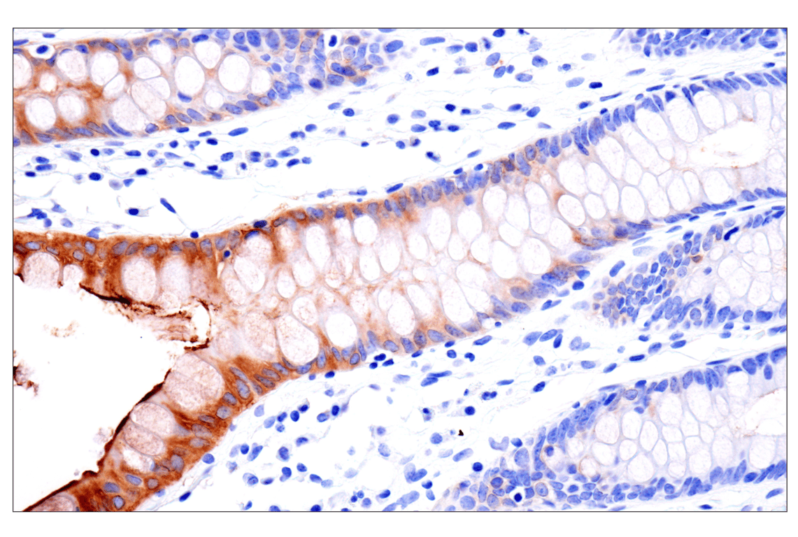 Immunohistochemistry Image 16: CD177 (F9O5U) Rabbit Monoclonal Antibody (BSA and Azide Free)