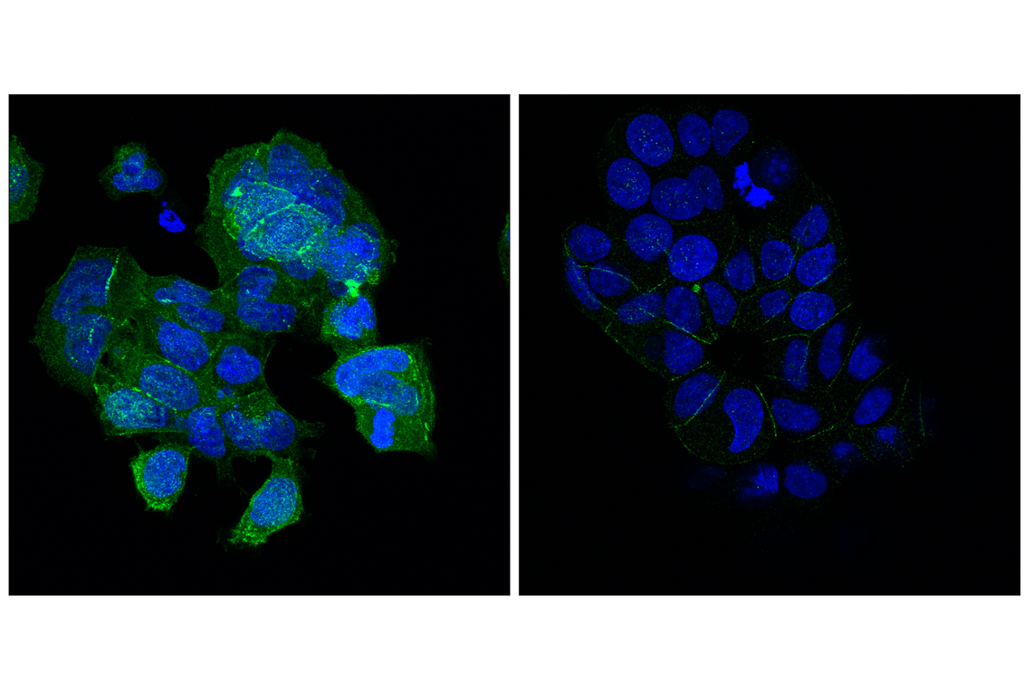Immunofluorescence Image 1: Angiomotin (F7W8U) Rabbit Monoclonal Antibody