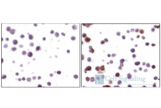 Immunohistochemistry Image 2: Cleaved Caspase-3 (Asp175) (5A1E) Rabbit Monoclonal Antibody (BSA and Azide Free)