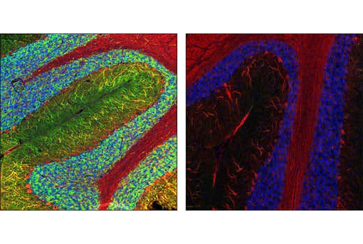 Immunofluorescence Image 1: Phospho-MAP2 (Ser136) Antibody