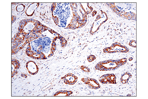 Immunohistochemistry Image 2: BCAT2 (D8K3O) Rabbit Monoclonal Antibody