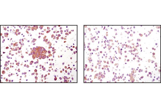 Immunohistochemistry Image 2: Phospho-GSK-3 beta (Ser9) (5B3) Rabbit Monoclonal Antibody