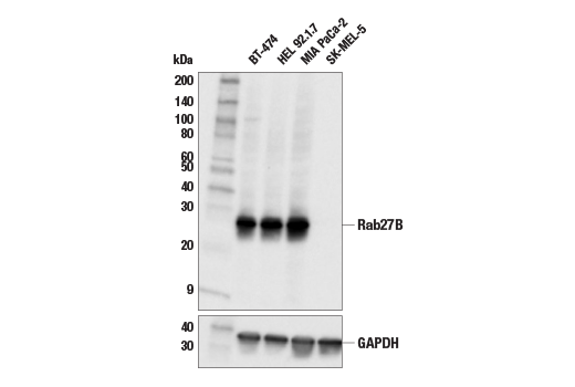 Western Blotting Image 2: Rab27B (E4V3O) Rabbit Monoclonal Antibody