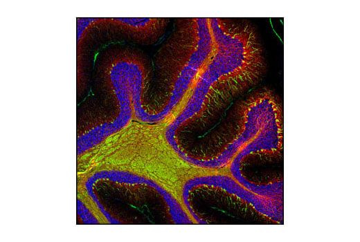 Immunofluorescence Image 1: beta3-Tubulin (TU-20) Mouse Monoclonal Antibody