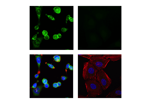 Immunofluorescence Image 1: IRF-5 (E7F9W) Rabbit Monoclonal Antibody (BSA and Azide Free)