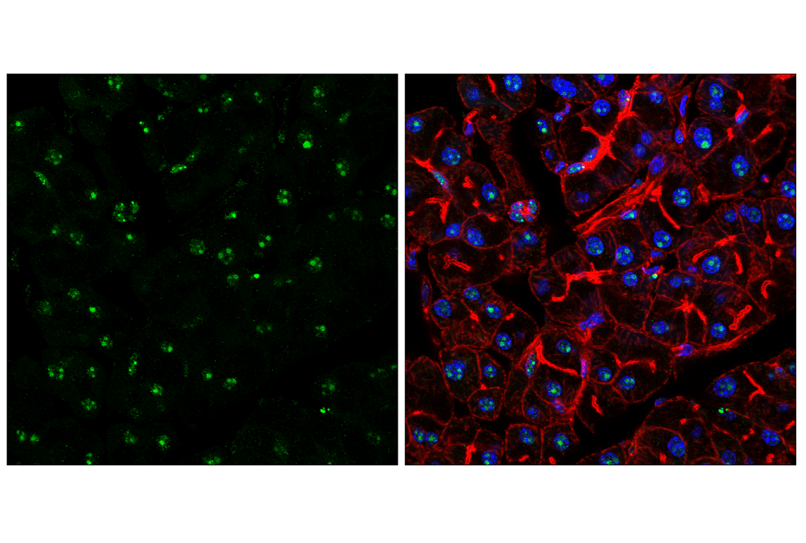 Immunofluorescence Image 1: NPM1 (E7W4P) Rabbit Monoclonal Antibody