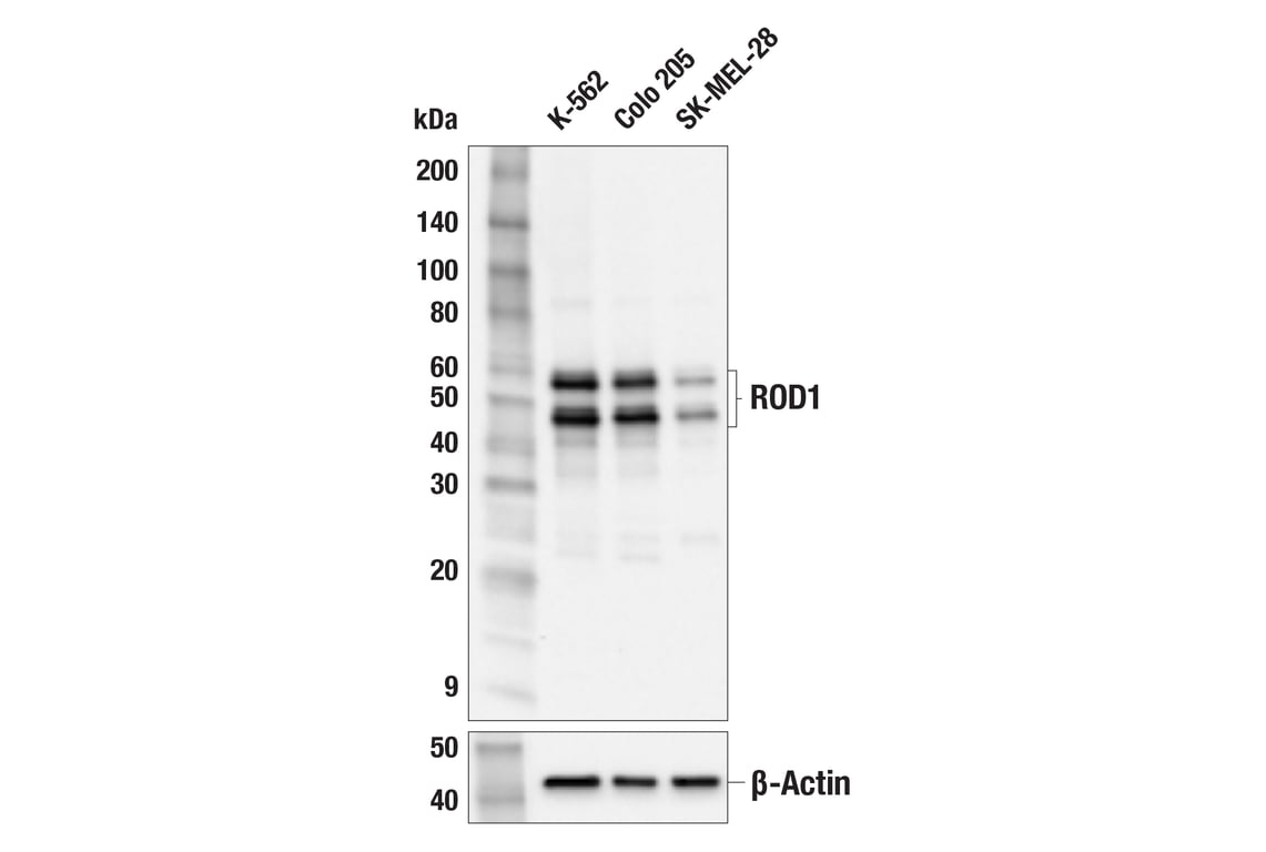 Western Blotting Image 2: ROD1 (E6B2J) Rabbit Monoclonal Antibody