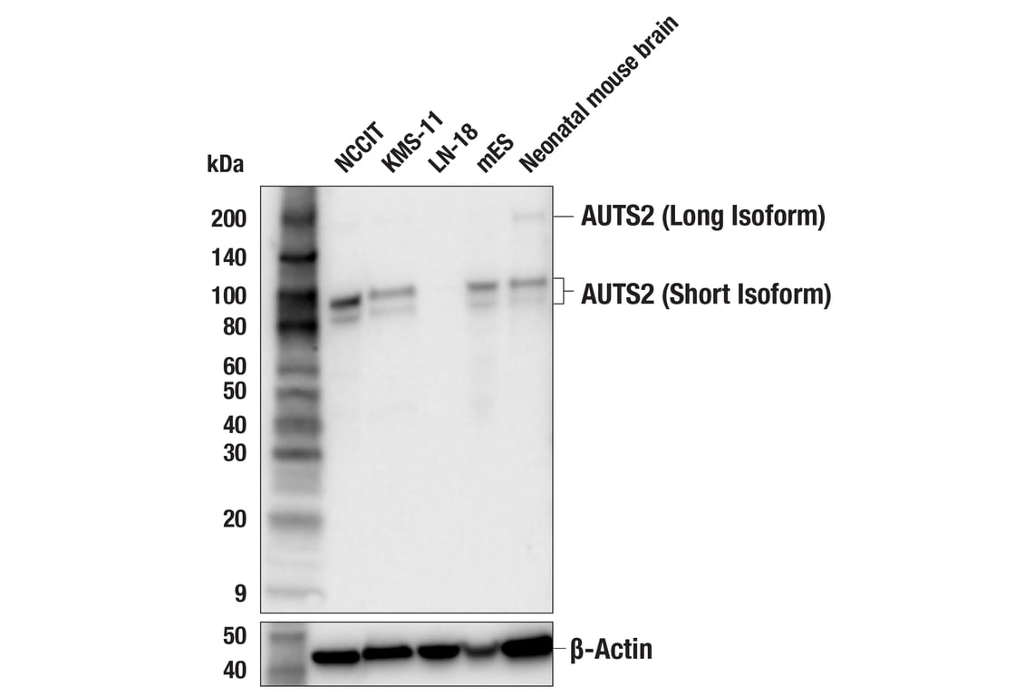 Western Blotting Image 2: AUTS2 (F3U1I) Rabbit Monoclonal Antibody