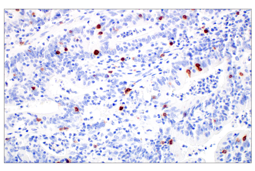 Immunohistochemistry Image 5: TRDC/TCR delta (E2E9T) Rabbit Monoclonal Antibody