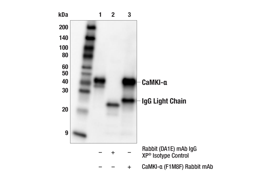 Immunoprecipitation Image 1: CaMKI-alpha (F1M8F) Rabbit Monoclonal Antibody