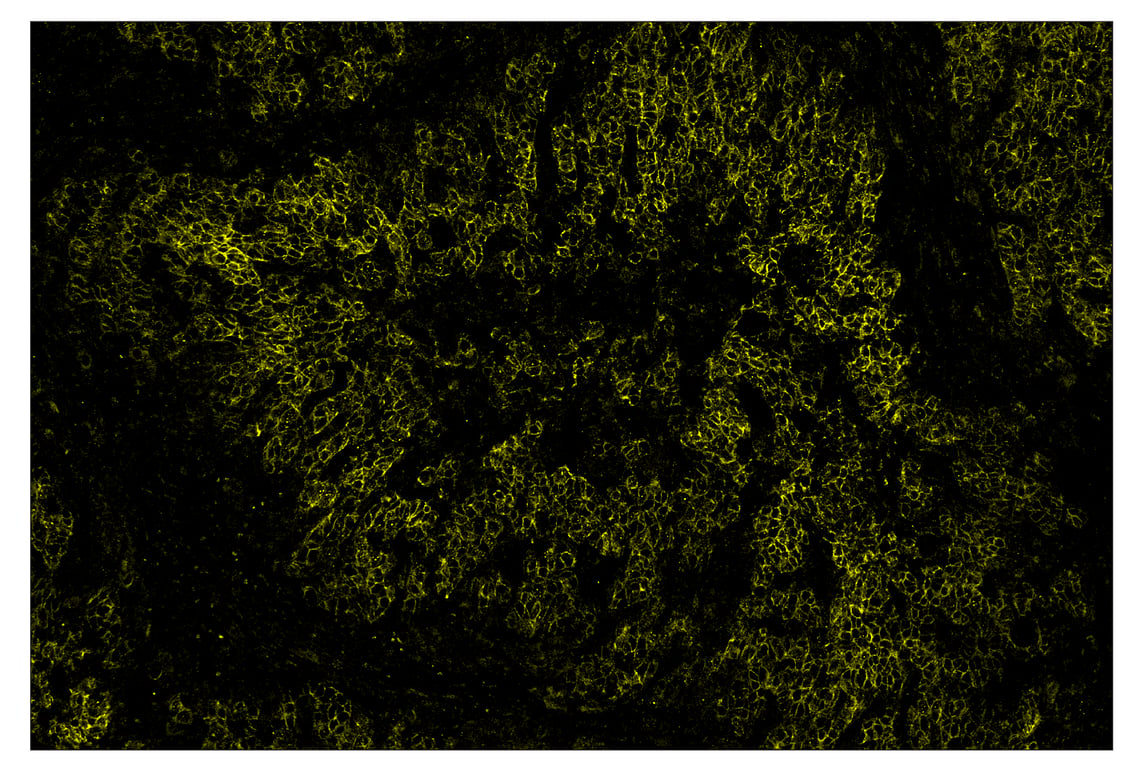 Immunohistochemistry Image 3: HER2/ErbB2 (D8F12) & CO-0019-488 SignalStar<sup>™</sup> Oligo-Antibody Pair