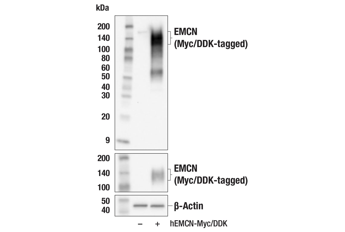 Western Blotting Image 2: EMCN (E3Z4D) Rabbit Monoclonal Antibody (BSA and Azide Free)
