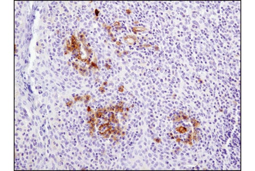 Immunohistochemistry Image 4: CD102/ICAM-2 (D7P2Q) Rabbit Monoclonal Antibody